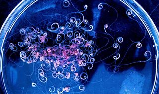 A view of a petri dish with hundreds of tiny spiral-shaped worms in it