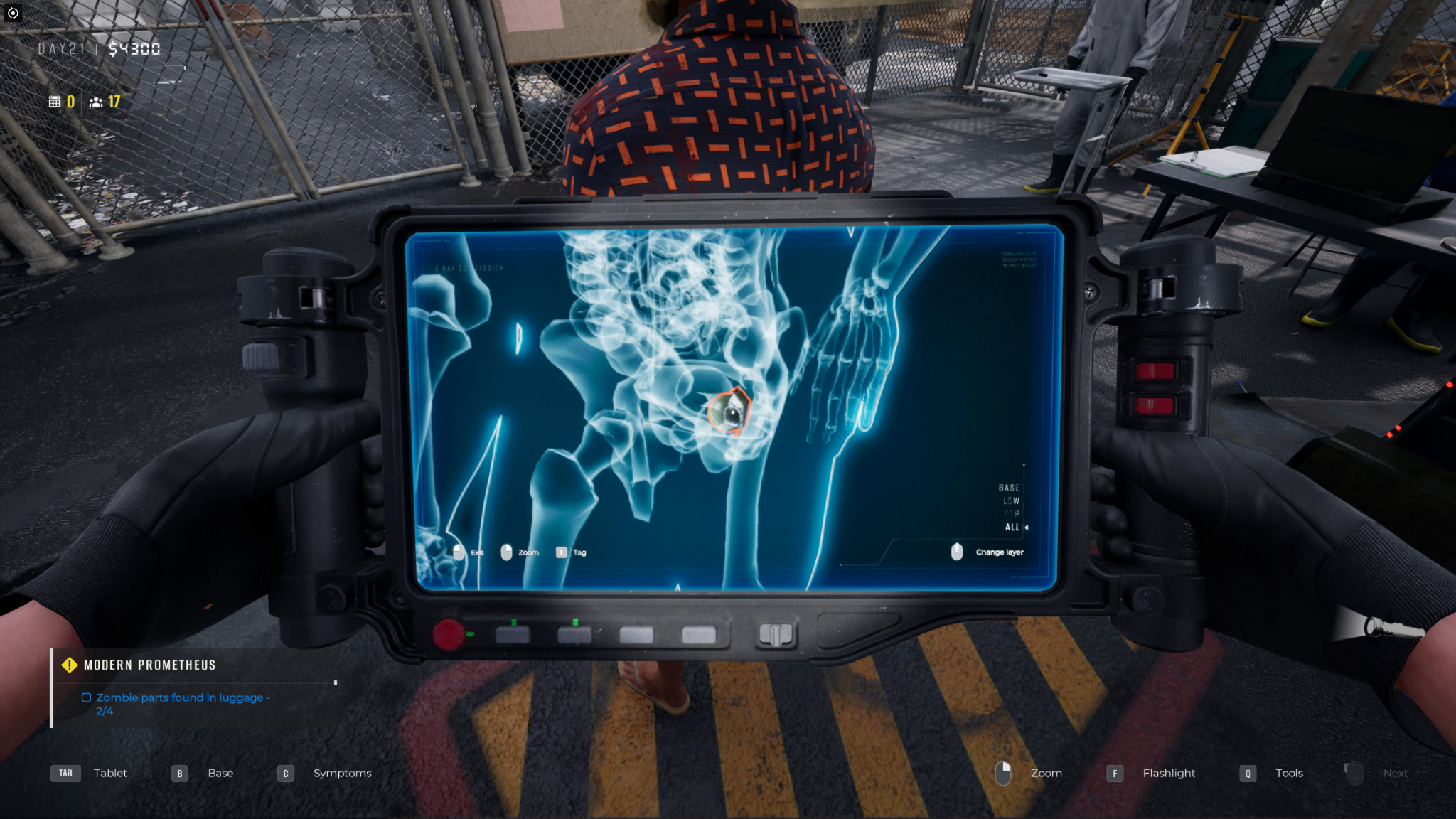 An X-Ray scanning someone's insides