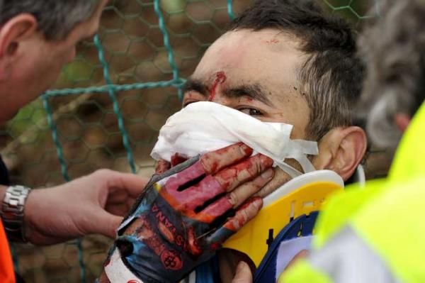 Assan Bazayez (Astana) receives medical attention after crashing in stage one.
