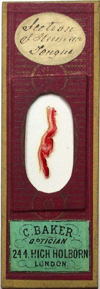 Microscope slide containing section of human tongue dyed to reveal the tiny blood vessels within it. Microscopes were a popular form of entertainment for science-obsessed people living in Victorian-era Britain.