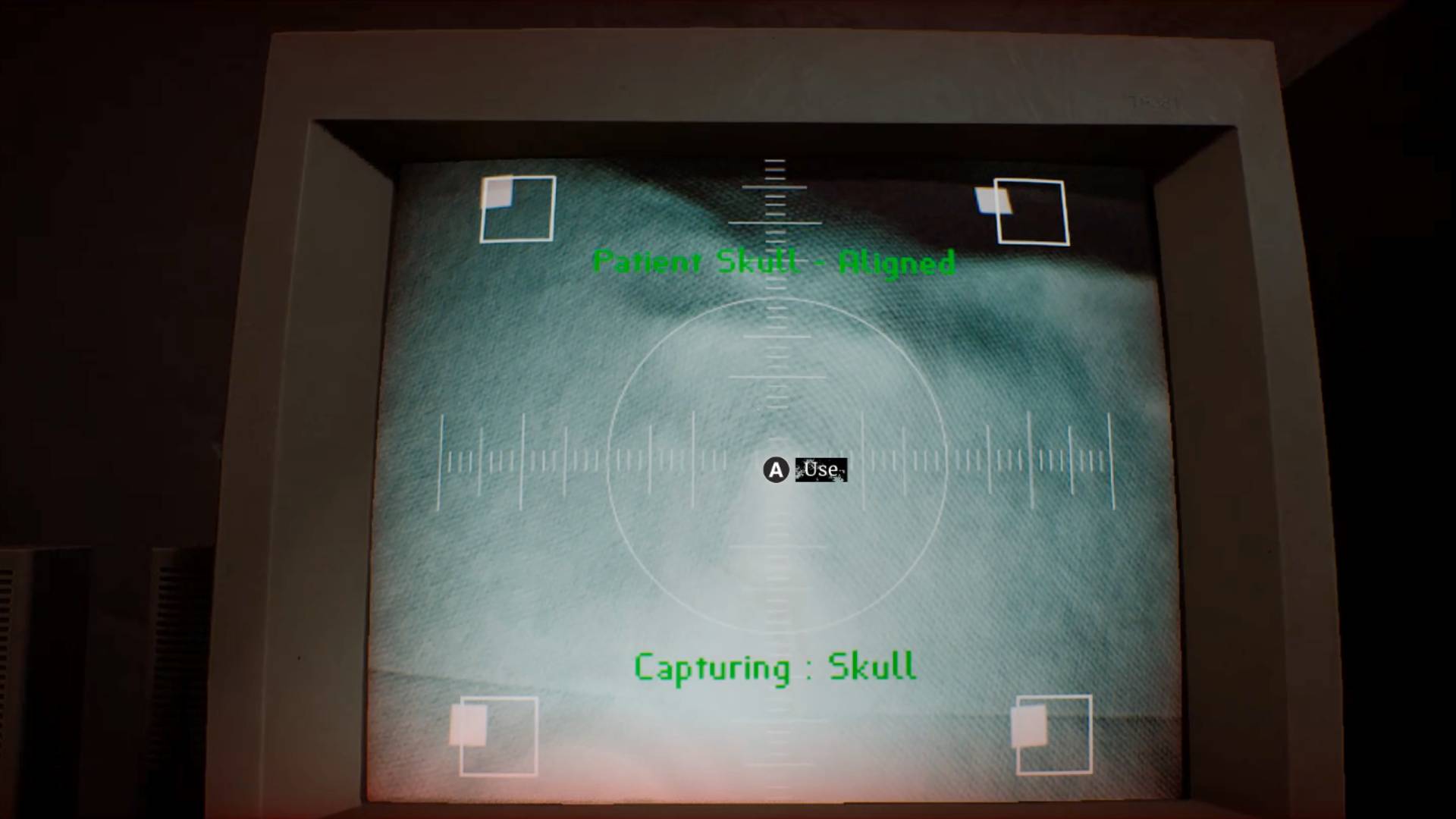 Silent Hill Townfall skull x-ray