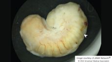 close up of a yellowish-white grub curled up into a C shape