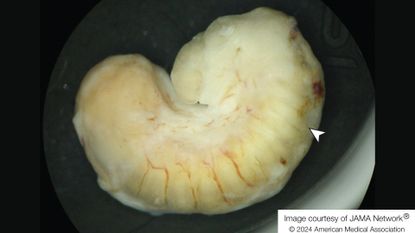 close up of a yellowish-white grub curled up into a C shape