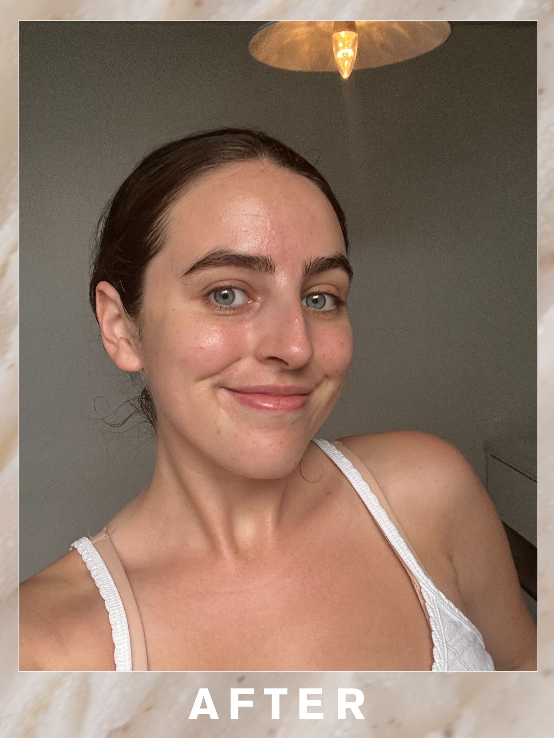 Ava before the Pfeffer Sal Three Sixty Facial