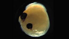 Scientists grew brain organoids with optic cups.