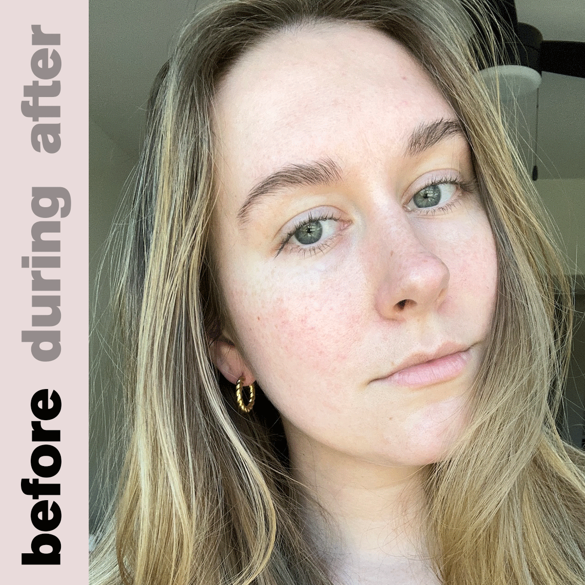 Editor Kaitlyn McLintock before, after, and while wearing an ESW Beauty sheet mask