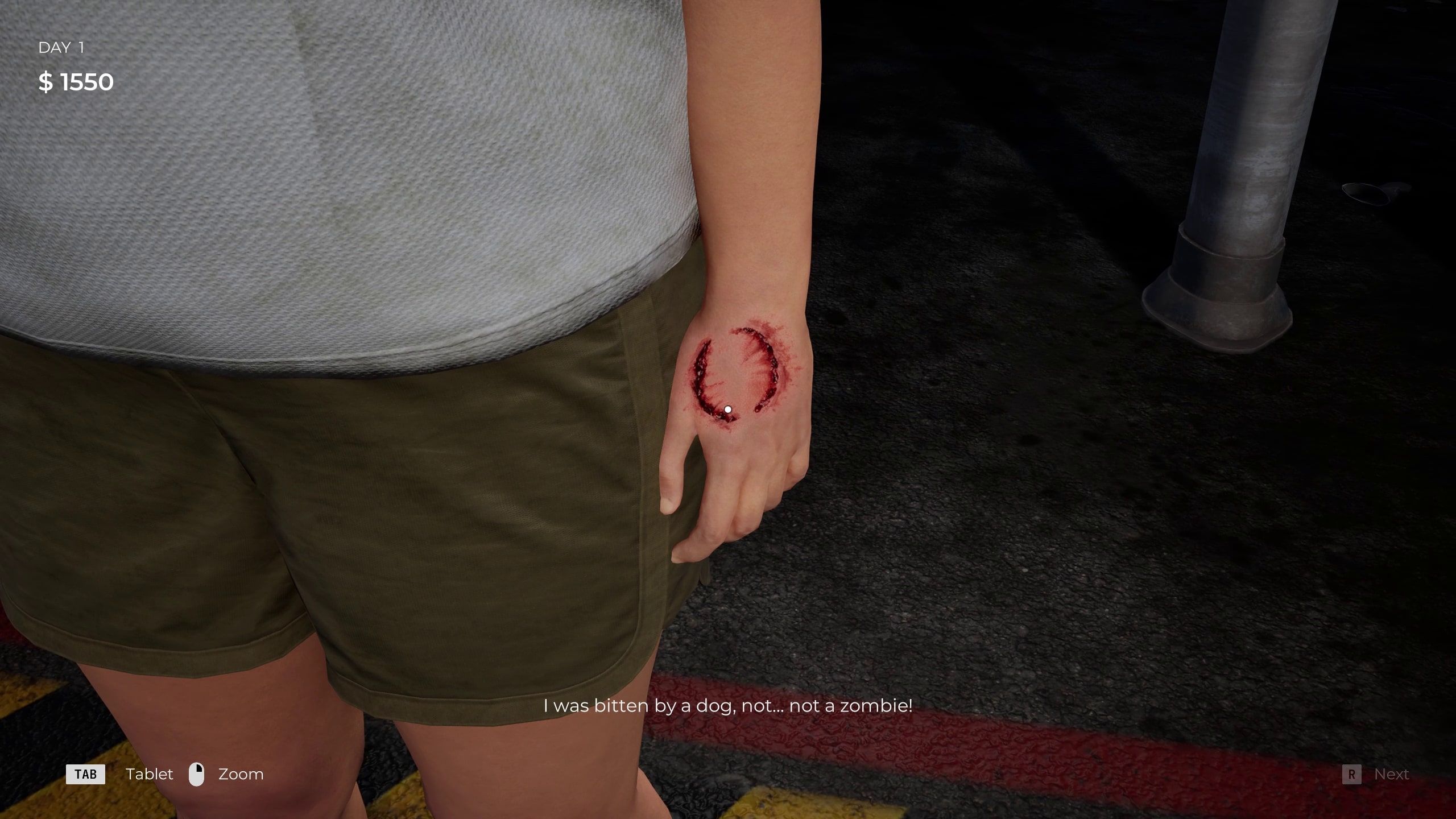 A zombie bite on someone's hand