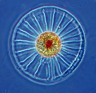 Photo of a wagon wheel diatom under the microscope.