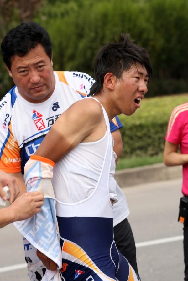 Yep, that hurts: This rider suffered a broken collarbone on the stage.