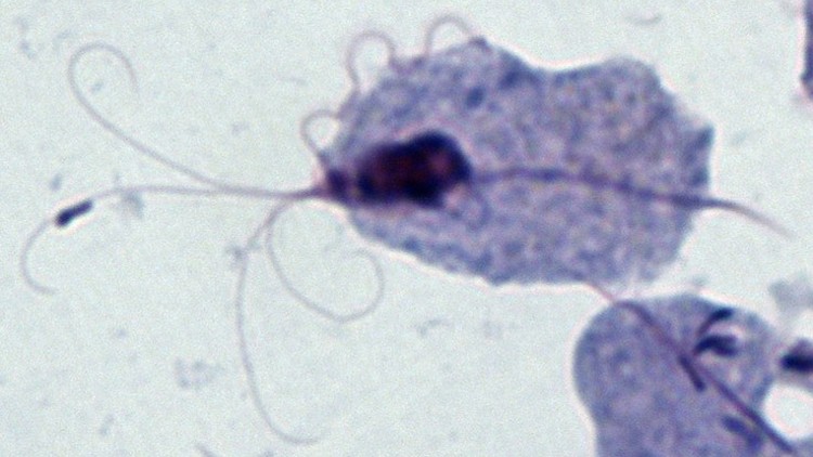 A photo of Trichomonas vaginalis, the parasite that causes trichomoniasis.