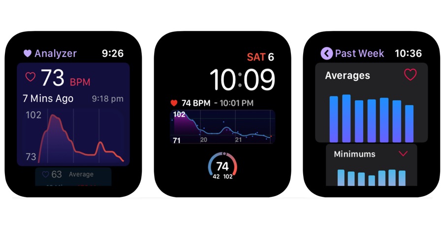 Heart Analyzer