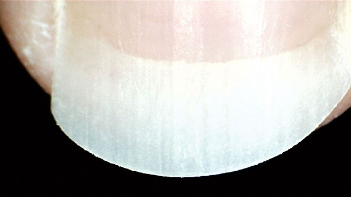 How your fingernails can improve your acoustic guitar tone MusicRadar