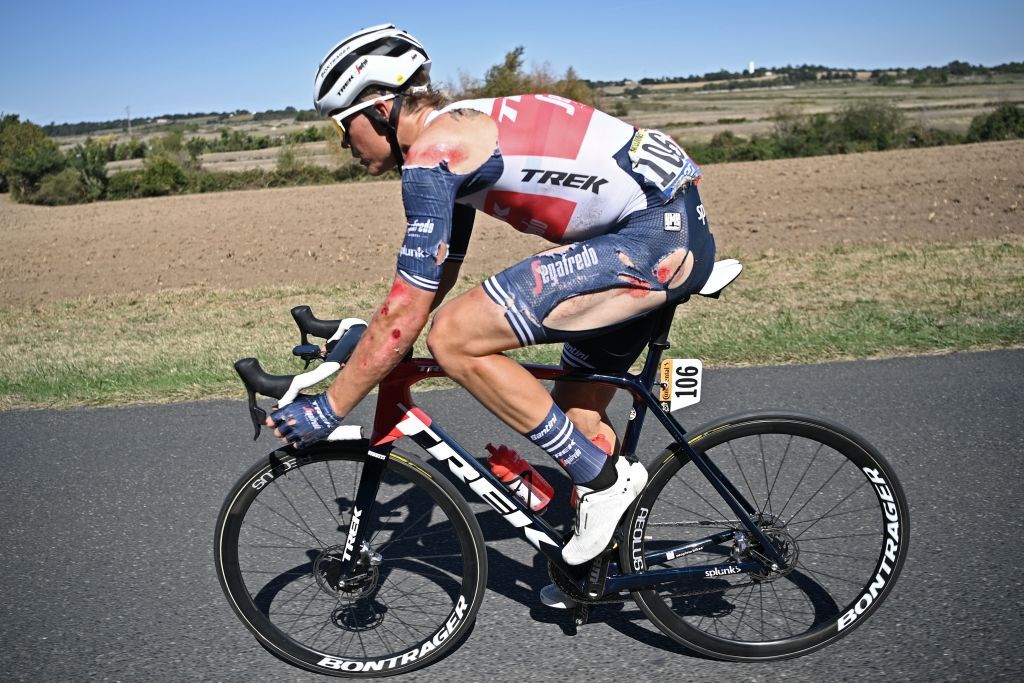 Toms Skujin&scaron; (Trek-Segafredo) suffered painful road rash after crashing