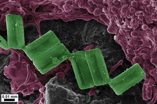 Diatoms (green) and potential ‘plastic-eater’ microbes (purple) on a tiny plastic debris.