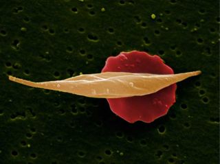 This image shows two red blood cells. The one in the front has been affected by sickle-cell anemia, and displays the characteristic sickle shape (a flattened C shape) common to the disease. This image received an award from the Wellcome Trust, as part of