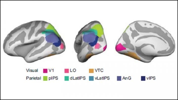 The brain regions in the parietal cortex involved in exaggerating similar memories. 