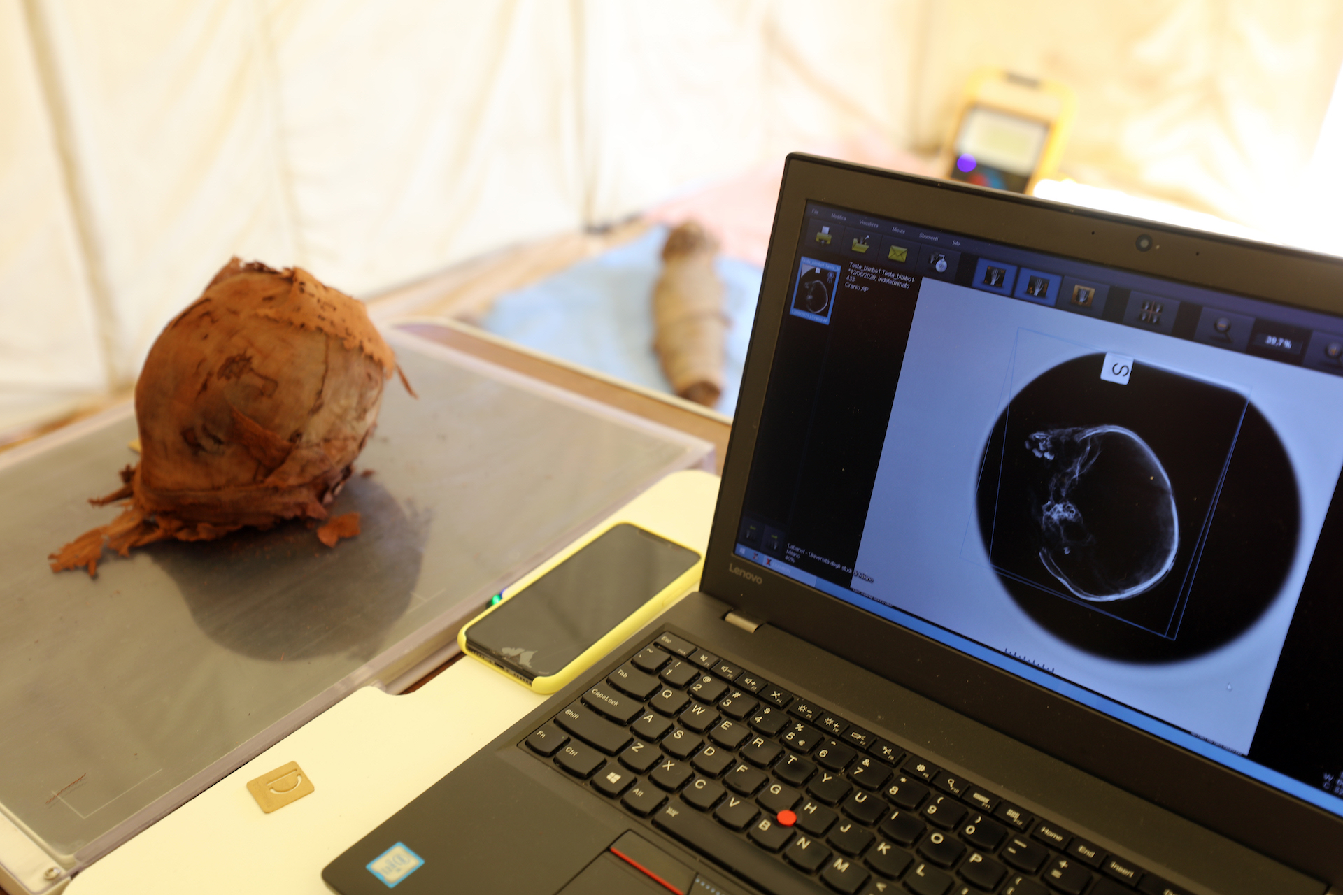 The researchers used a portable x-ray machine at the site to analyze the mummified head of a child.