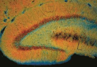 The dentate gyrus of the hippocampus is a main gate for entry of neocortical information to the hippocampus. Its numerous granule cells sparse the incoming information for their target neurons.