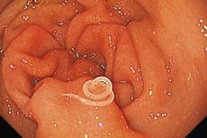 parasite, parasitic infection