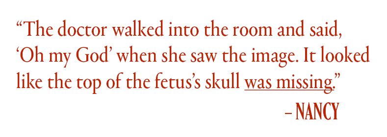 a pull quote reading "the doctor walked into the room and said 'oh my god' when she saw the image. it looked like the top of the fetus's skull was missing"