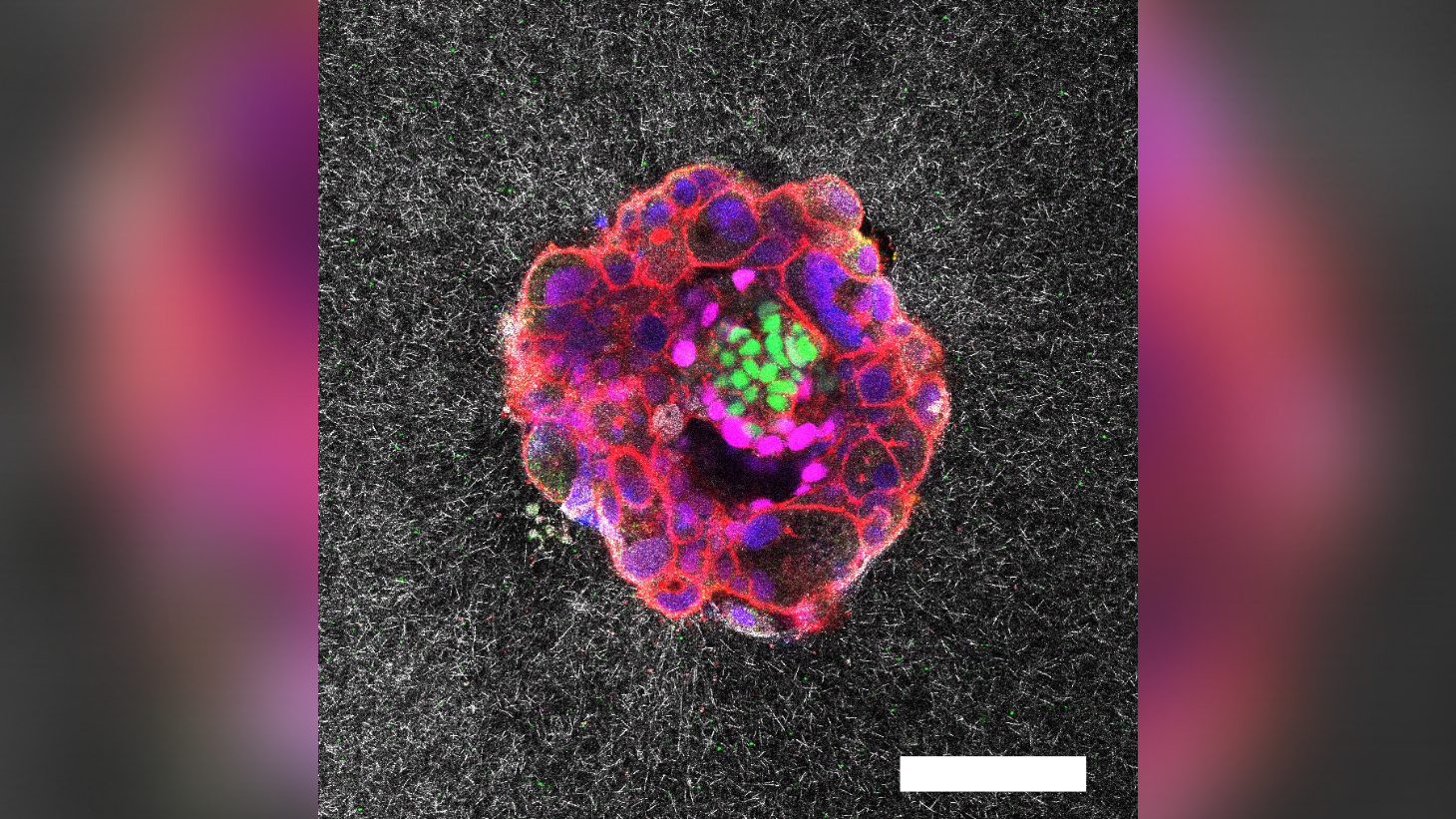 令人难以置信的第一种显示人类胚胎实时着床的视频 a pink, purple, red and green stained embryo against a mottled white-and-black background