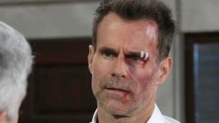 Cameron Mathison as Drew with bruises in General Hospital