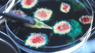 A petri dish with colorful blobs of microorganism growth on it