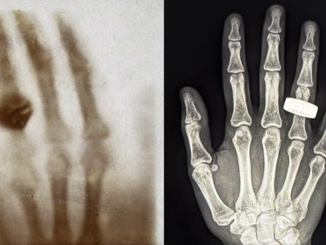 SpaceX's Fram2 mission captures 1st human X-ray in Earth orbit | Space