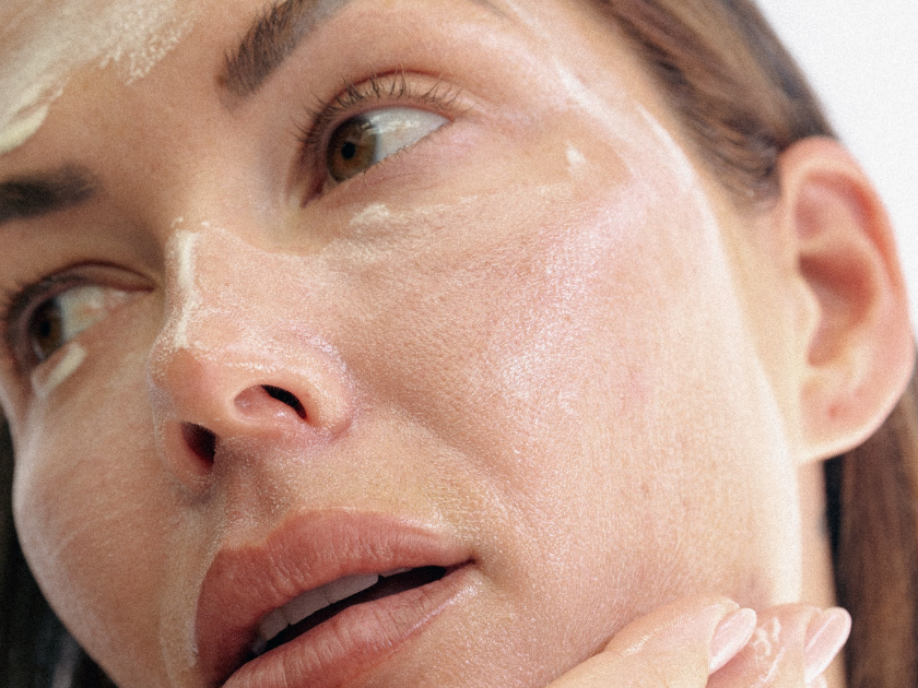 Spironolactone Is Being Called the GLP-1 of Acne—Here's What Derms Want Us to Know