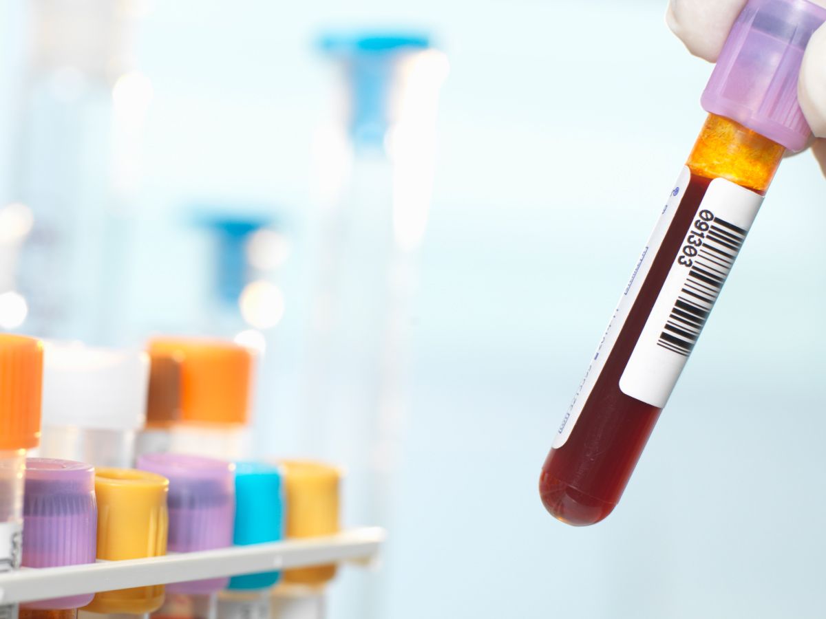 She is the only person in the world compatible with herself' — scientists  discover new blood type but it's unique to just one person from Guadeloupe  | Live Science
