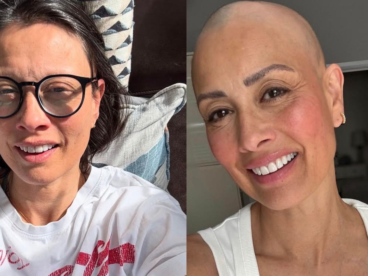 A year after revealing alopecia diagnosis, Melanie Sykes offers candid  update on hair loss | Woman & Home