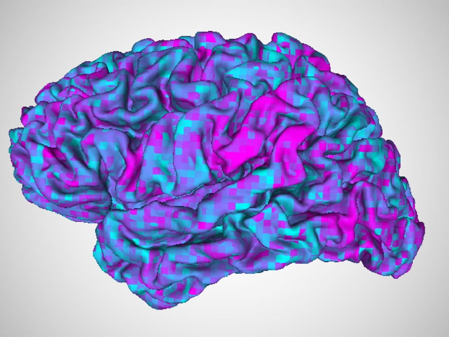 AI 'brain decoder' can read a person's thoughts with just a quick brain  scan and almost no training | Live Science, image size:1440x1080