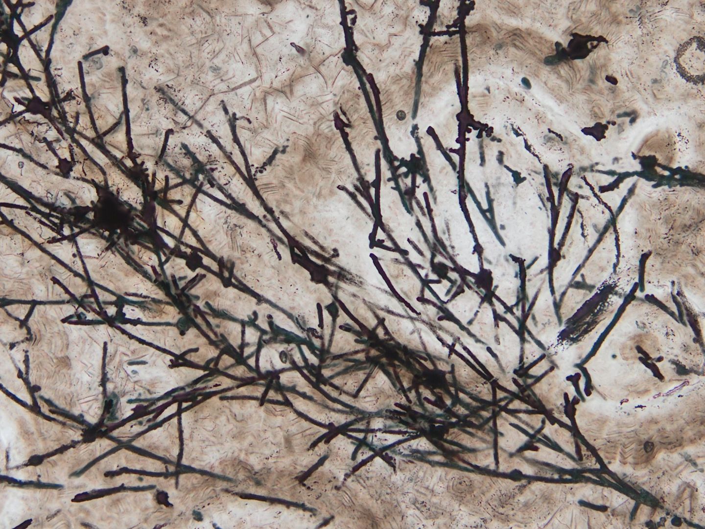 635 million-year-old fossil is the oldest known land fungus | Live