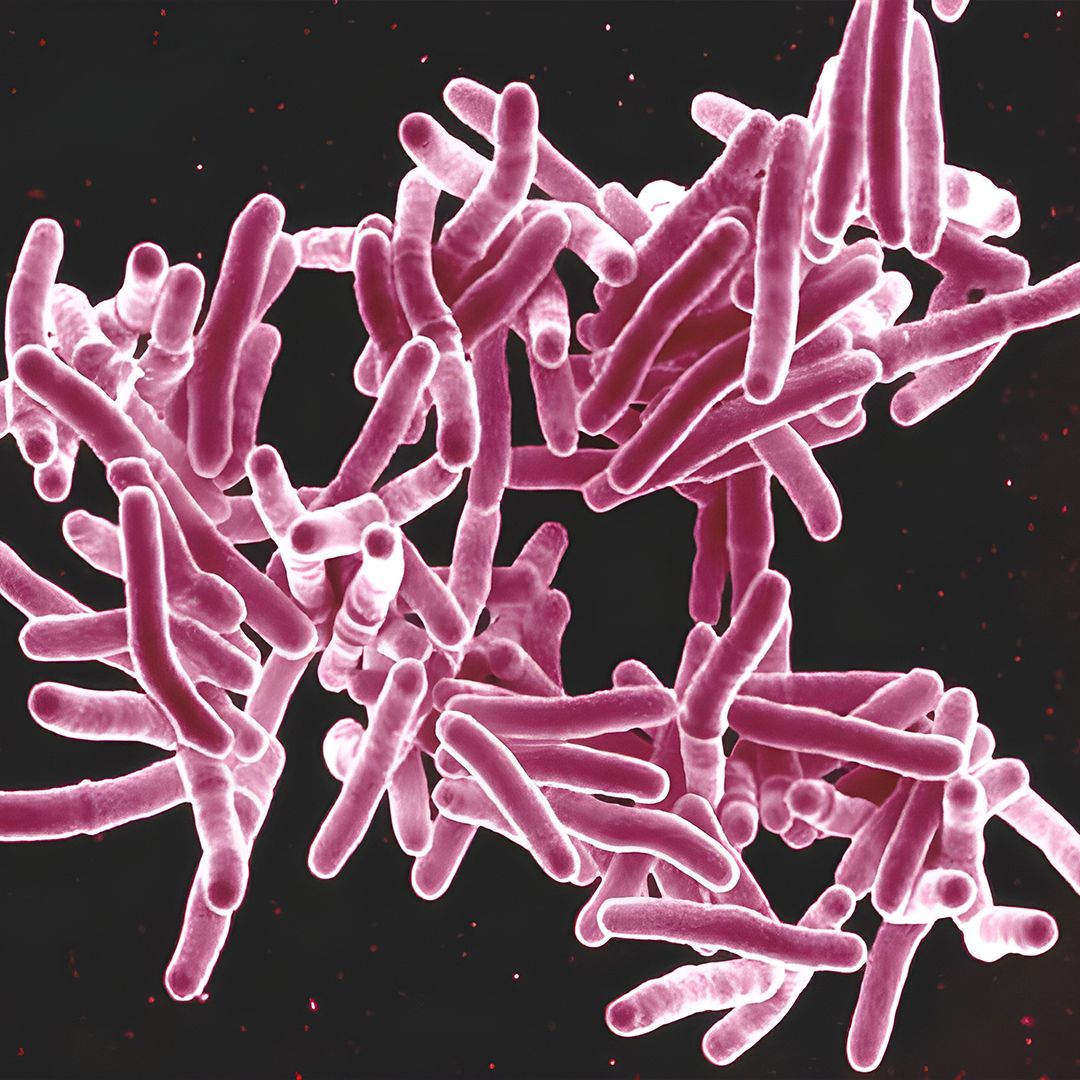 健康・医学 Tuberculosis cEsJcRPRbVeDTjq4PZEagc.jpg