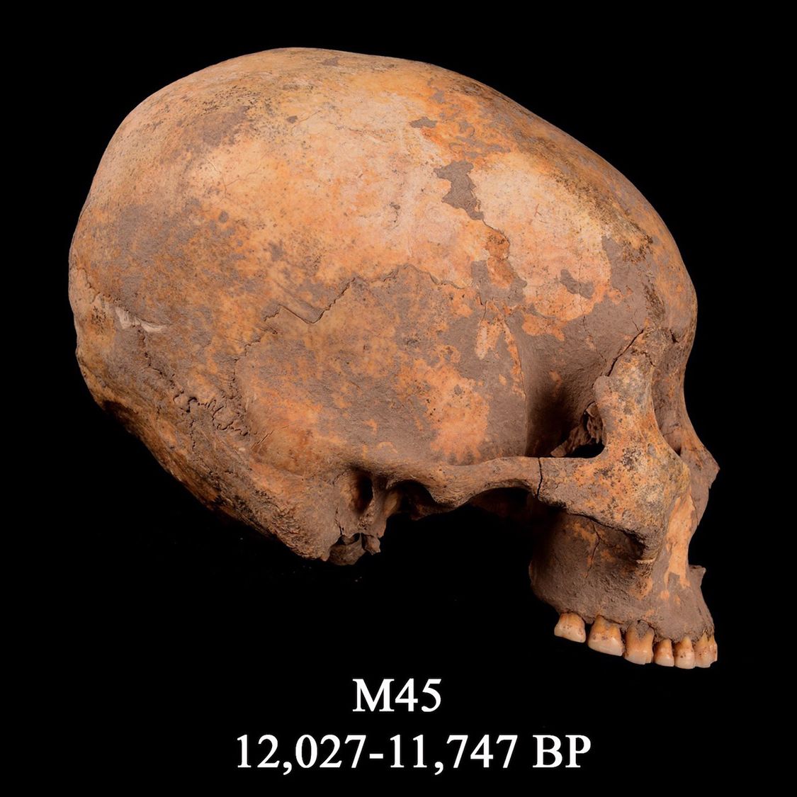 12,000 Years Ago, a Boy Had His Skull Squashed into a Cone Shape. It's the  Oldest Evidence of Such Head-Shaping. | Live Science, image size:1125x1125