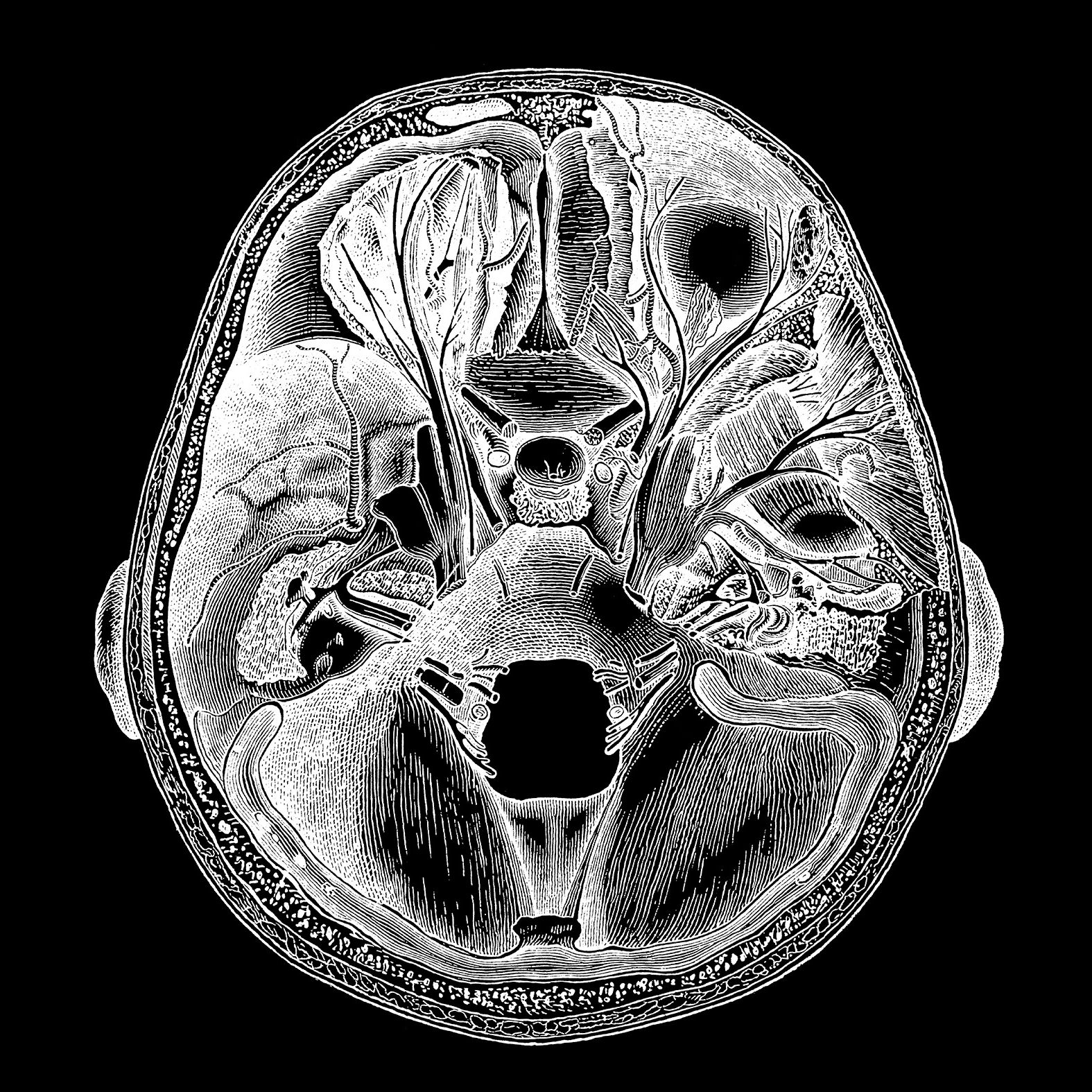 Lobotomy: Definition, procedure and history | Live Science, image size:1575x1575