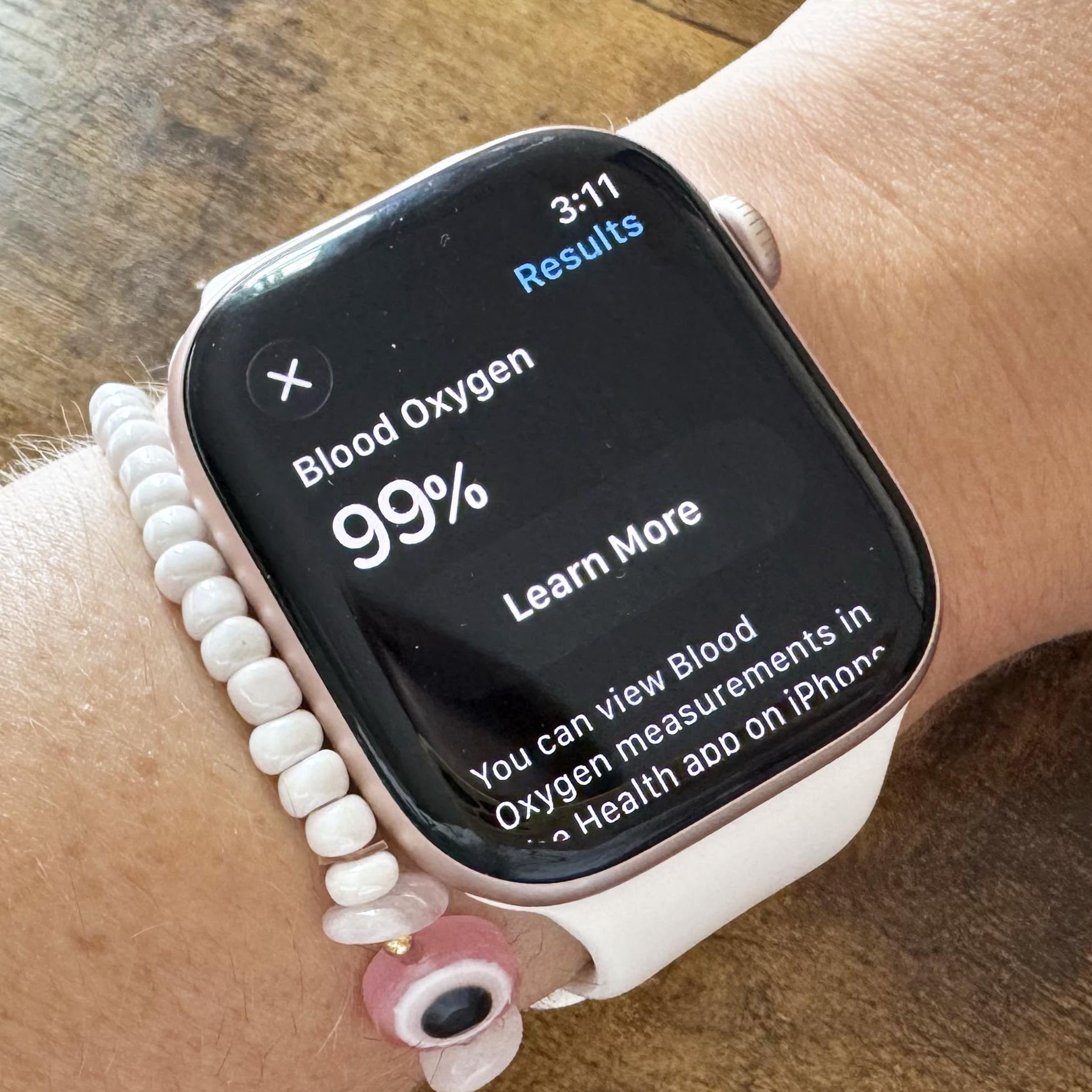 Iphone Apple Watch Series Logo Apple Watch (Series 3) 38mm
