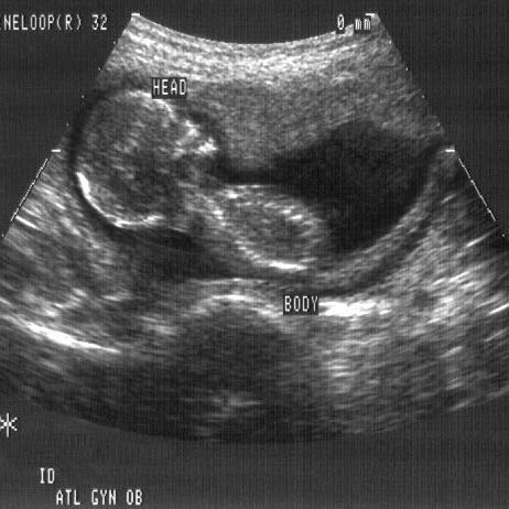 male fetus masturbate Can fetuses masturbate? main image 0