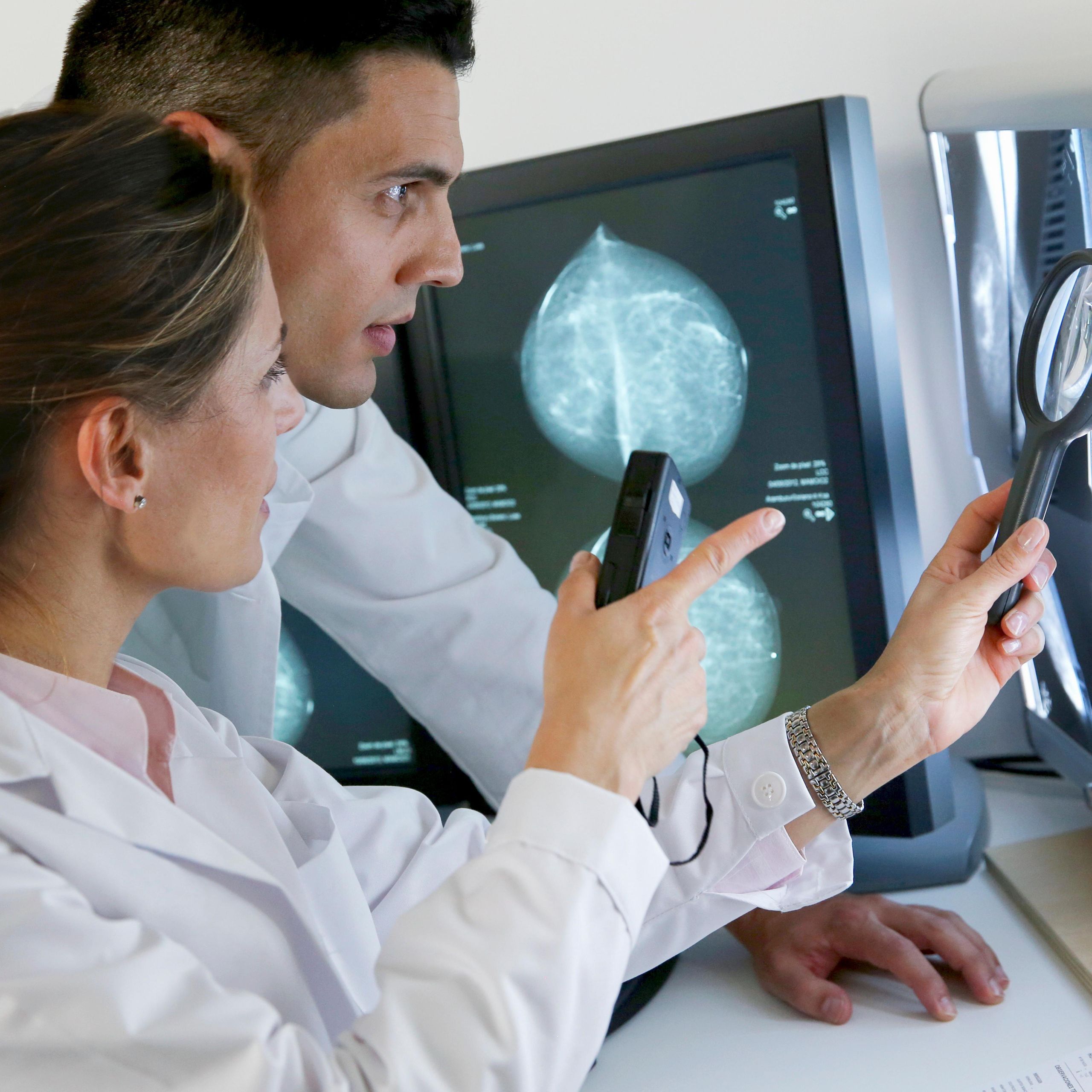 How blockchain could help spot breast cancer | The Week