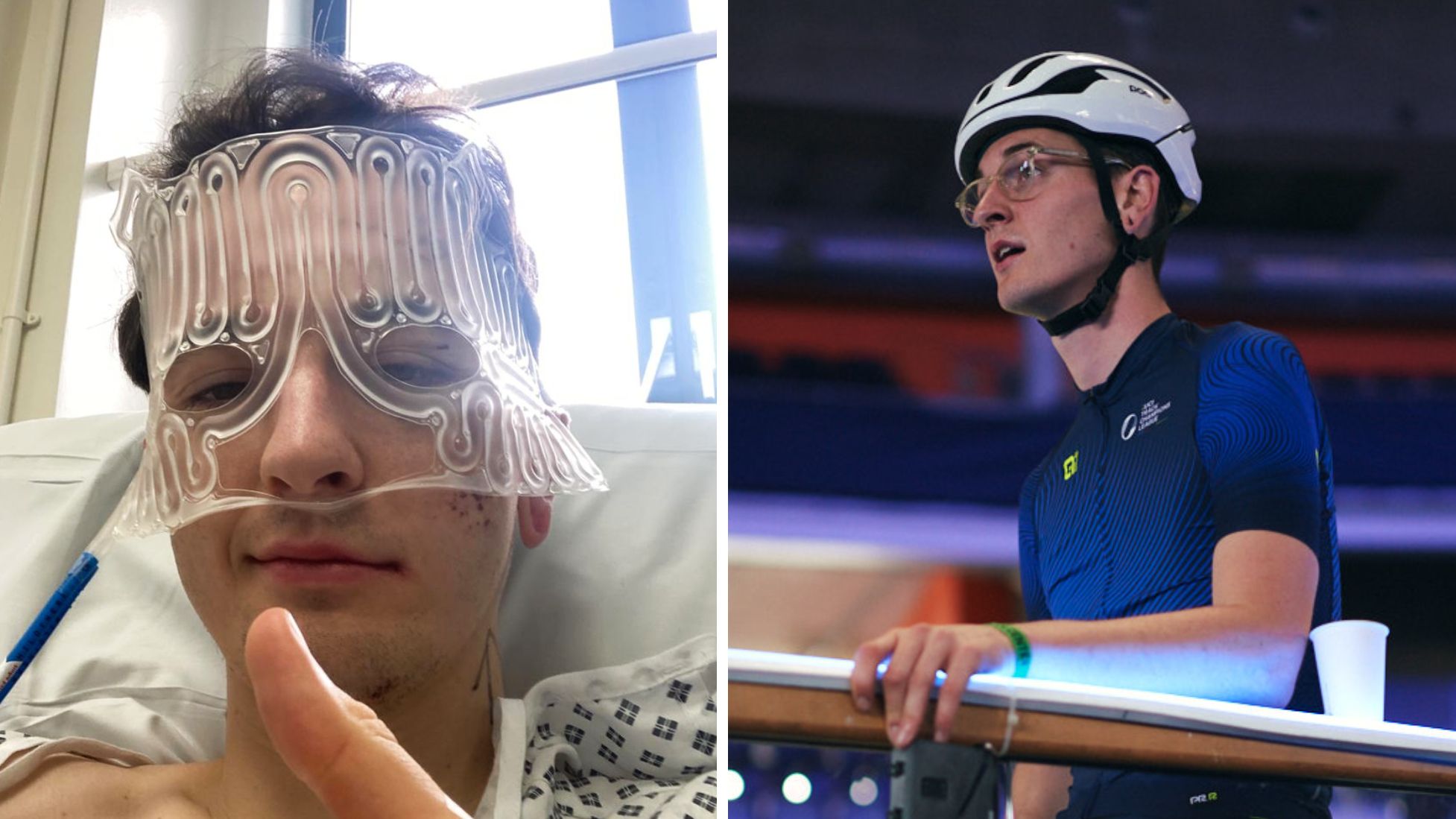 I crashed my bike and broke my face in three places - my helmet might have  saved my life | Cycling Weekly