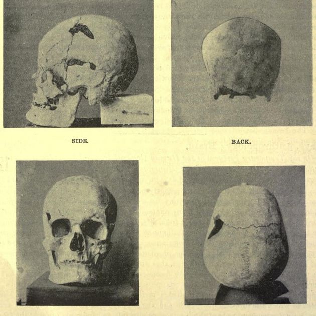 Ancient Egyptian Pharaoh May Be the 1st Known 'Giant' | Live Science