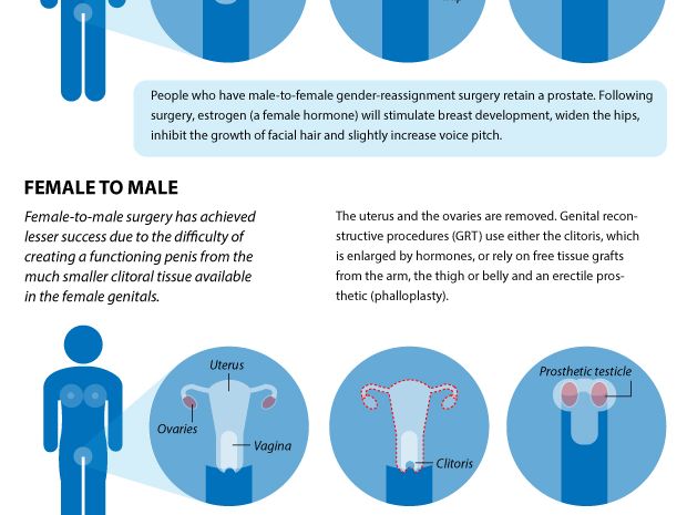 Transgender Surgery Male To Female Operation