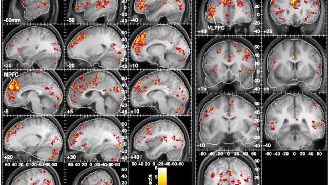 Music-Memory Connection Found in Brain | Live Science