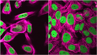 microscopic photographs of human cells