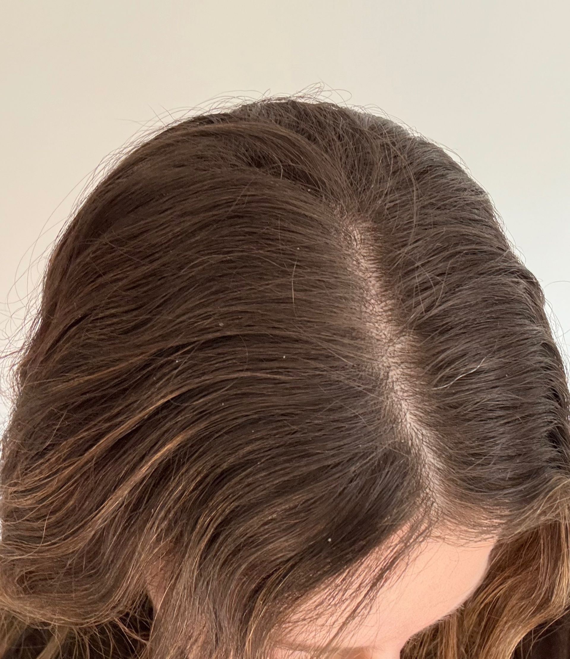 Photo of Jamie Schneider's scalp before testing the Rōz Salt Scalp Scrub