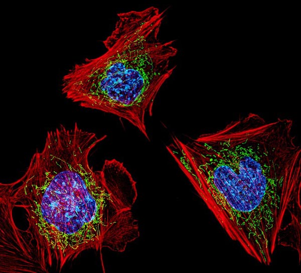 ibrolblasts are the most common cells in mammalian connective tissue 