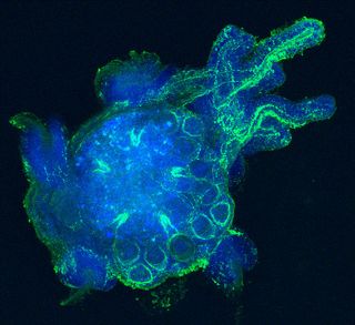 The signaling molecule histamine is visible in green in the blue cells of this sea urchin larva (Strongylocentrotus purpuratus).