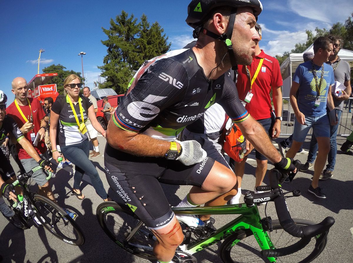 A bandaged and sore Cavendish heads to the team bus