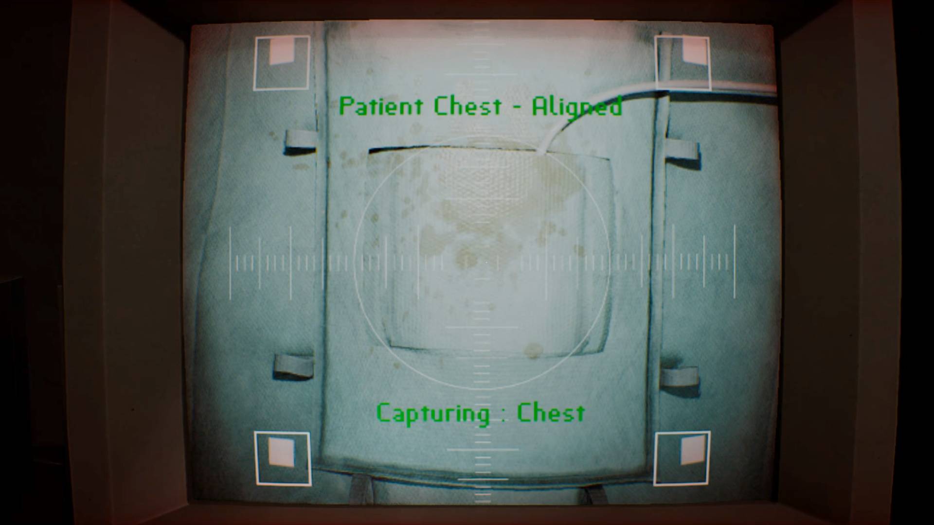Silent Hill Townfall chest x-ray