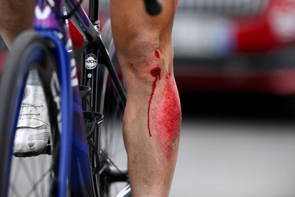 A Tour de France Femmes rider after crashing during stage two of the Tour de France Femmes